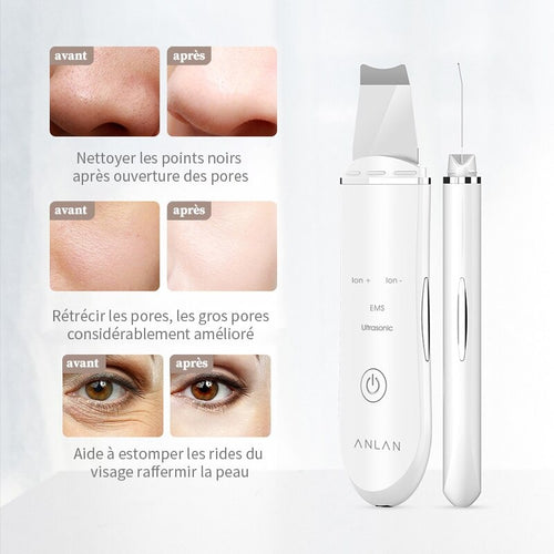 Épurateur ultrasonique du visage