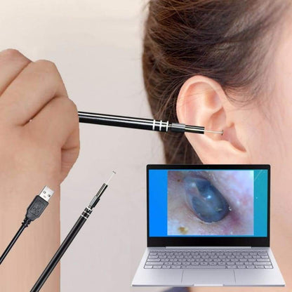 kit De Nettoyage De Canal Oreille avec Caméra Endoscope - Livraison Gratuite - Oreille Soins