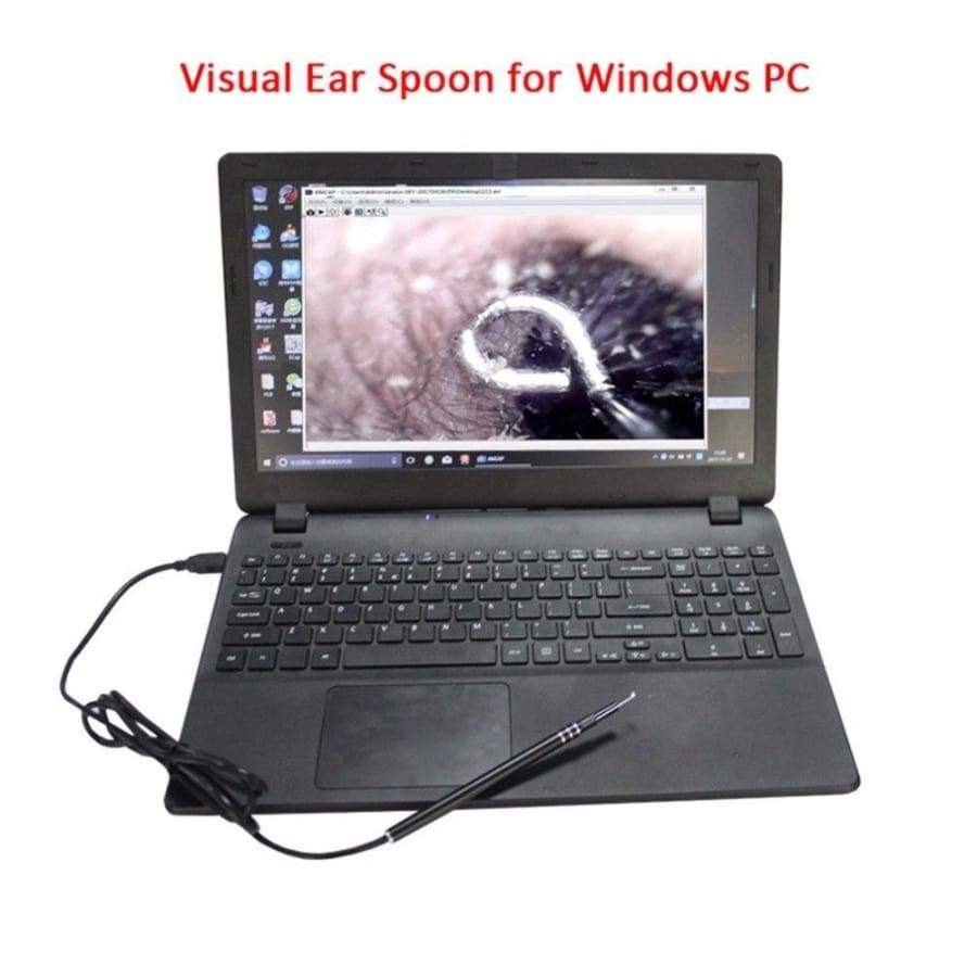 Kanoscope de nettoyage d'oreille visuel Wi-fi sans fil, kit de livres HD  1296P, bâtons de retrait, caméra endoscopique, outil d'avertissement d' oreille